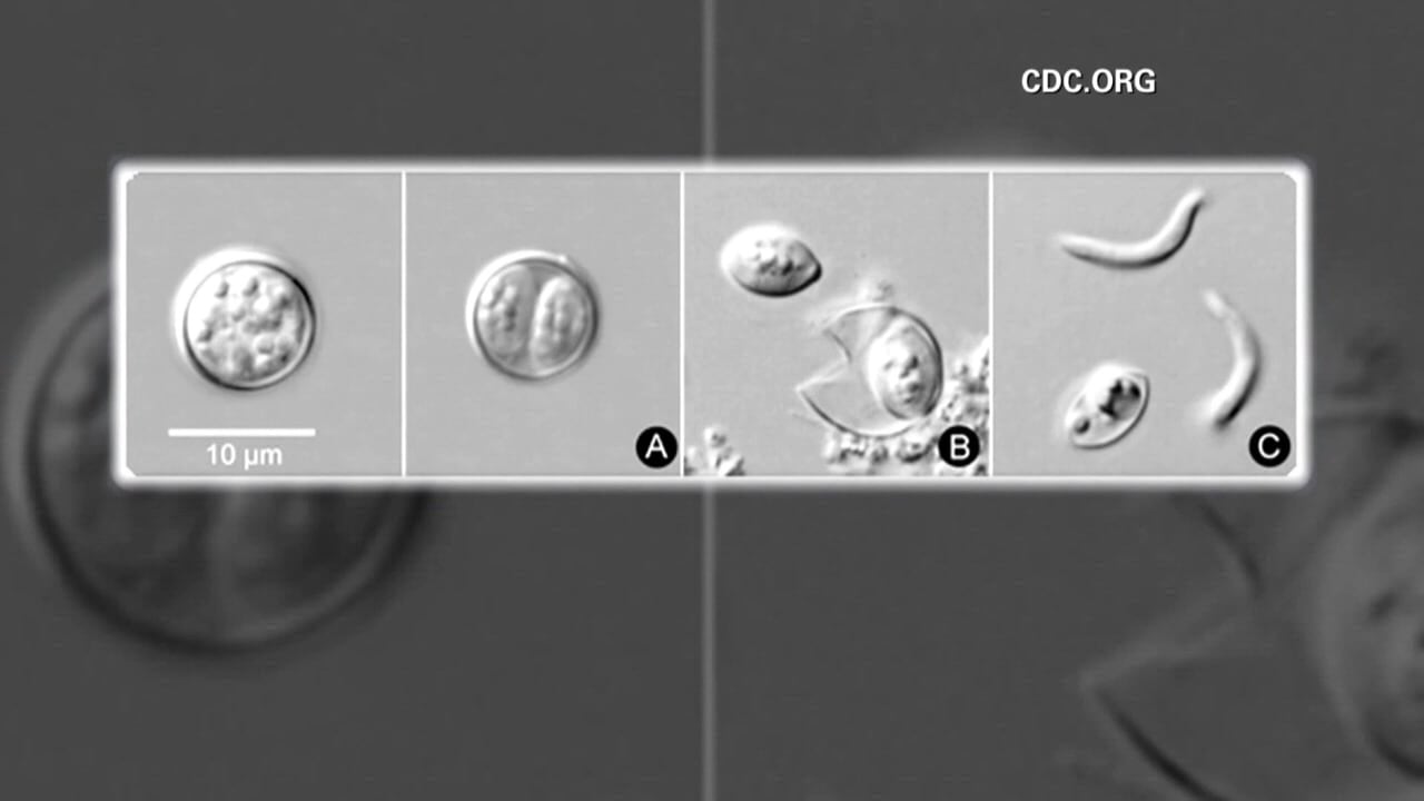 Kentucky health officials investigating over 600 reported cases of cyclosporiasis