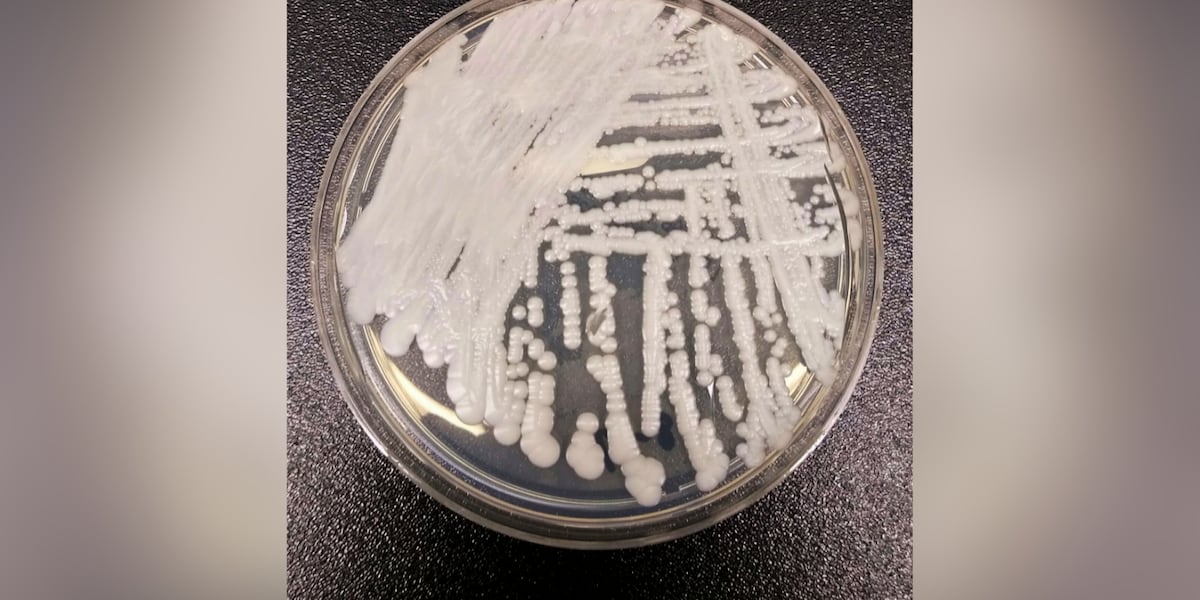 ‘Superbug’ fungus has spread to half the US. Should you be concerned?