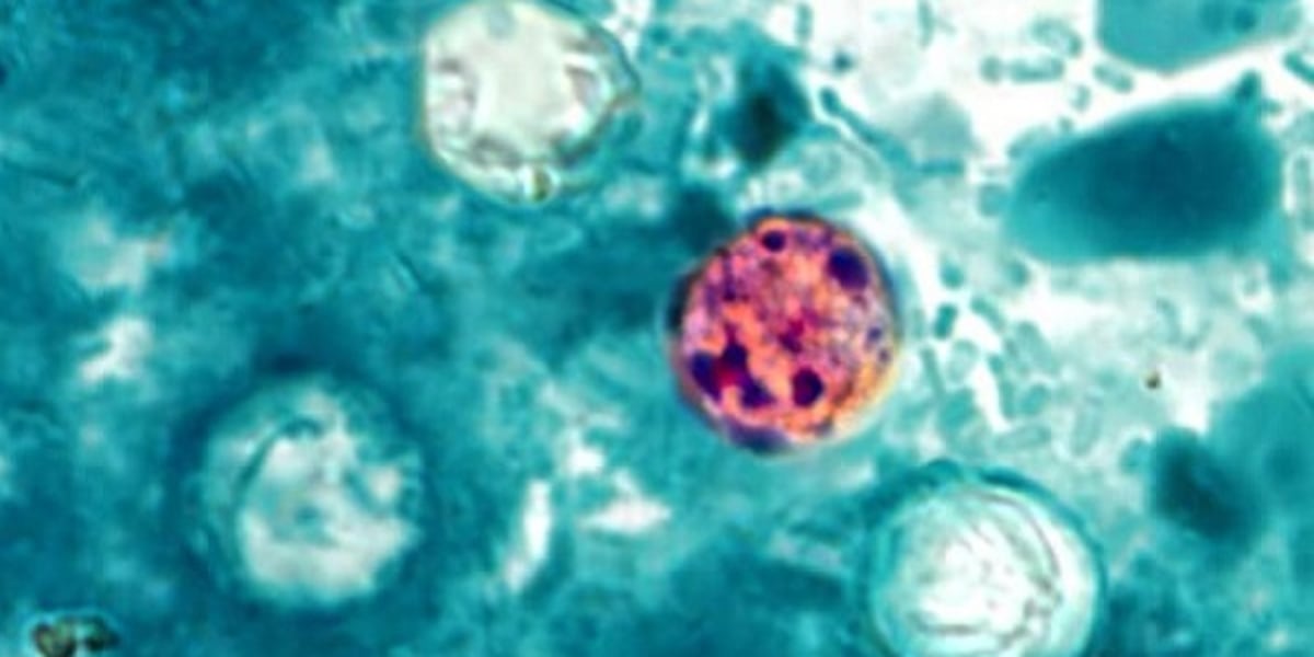 Fact✓Check|Kentucky cyclosporiasis cases climb amid debate over federal funding cuts