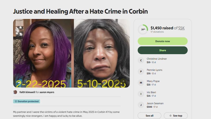 Ky. woman starts GoFundMe to pay for medical bills after assault.