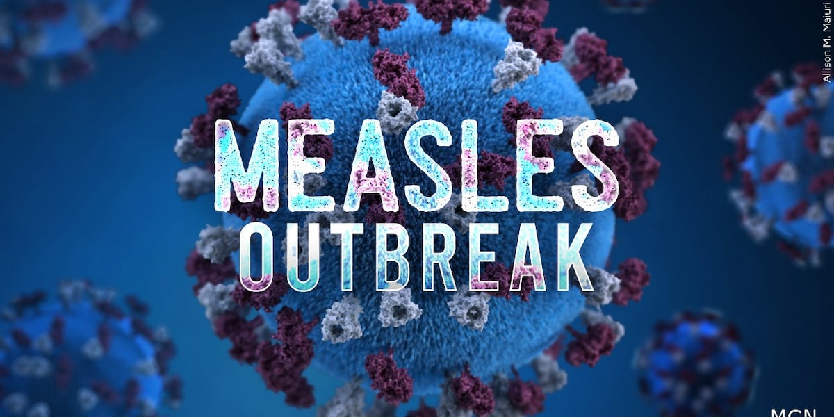 Kentucky health officials confirm ongoing measles outbreak