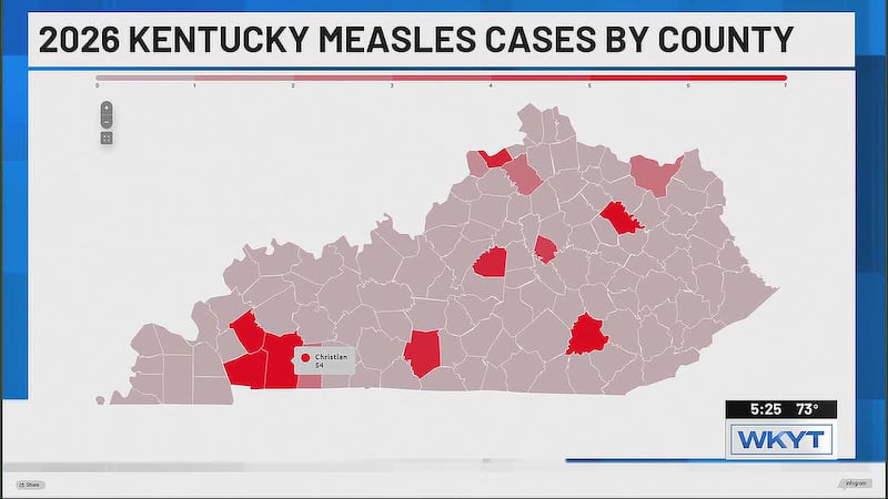 Better Living: New measles cases in Kentucky